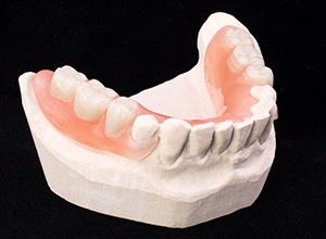 Model of smile with partial dentures
