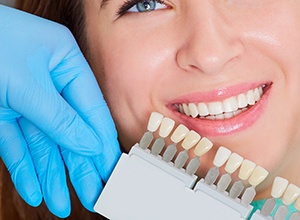 Smile compared with tooth shading chart