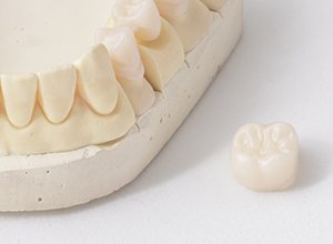 Dental crown sitting on table top