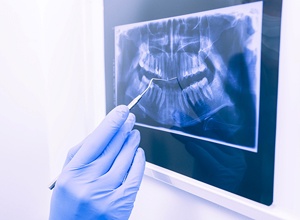 dental X-ray
