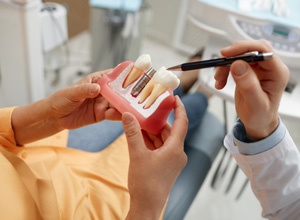 Dentist using model to explain concept of dental implants