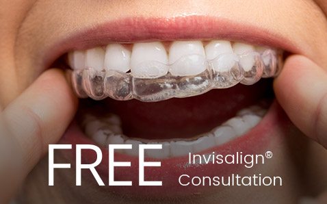 Patient inserting Invisalign® tray