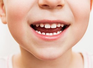 Closeup of child's healthy smile