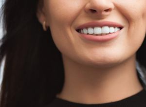 close-up of perfect smile