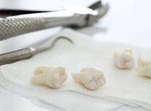 extracted teeth