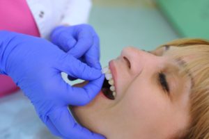 Dental patient getting fitted for new veneers