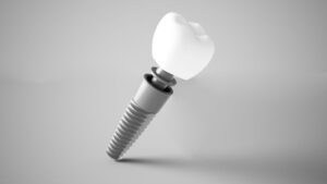 Dental implant, abutment, and crown against gray background